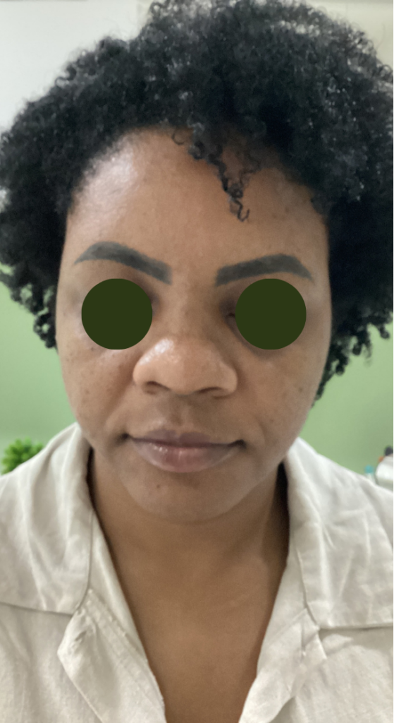 Resultado após os cuidados com a pele, vista frontal